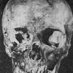 czaszka przypisywana Bolesławowi III Krzywoustemu